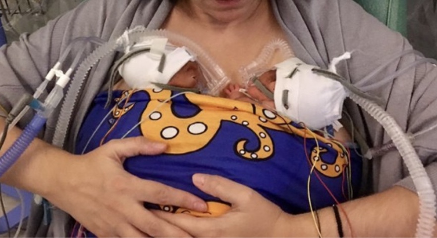 Badanas para poder llevar bebés prematuros